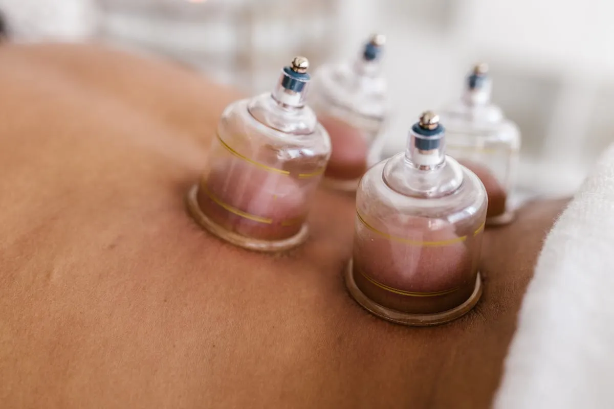 Gros plan d’une séance de Hijama avec pose de ventouses