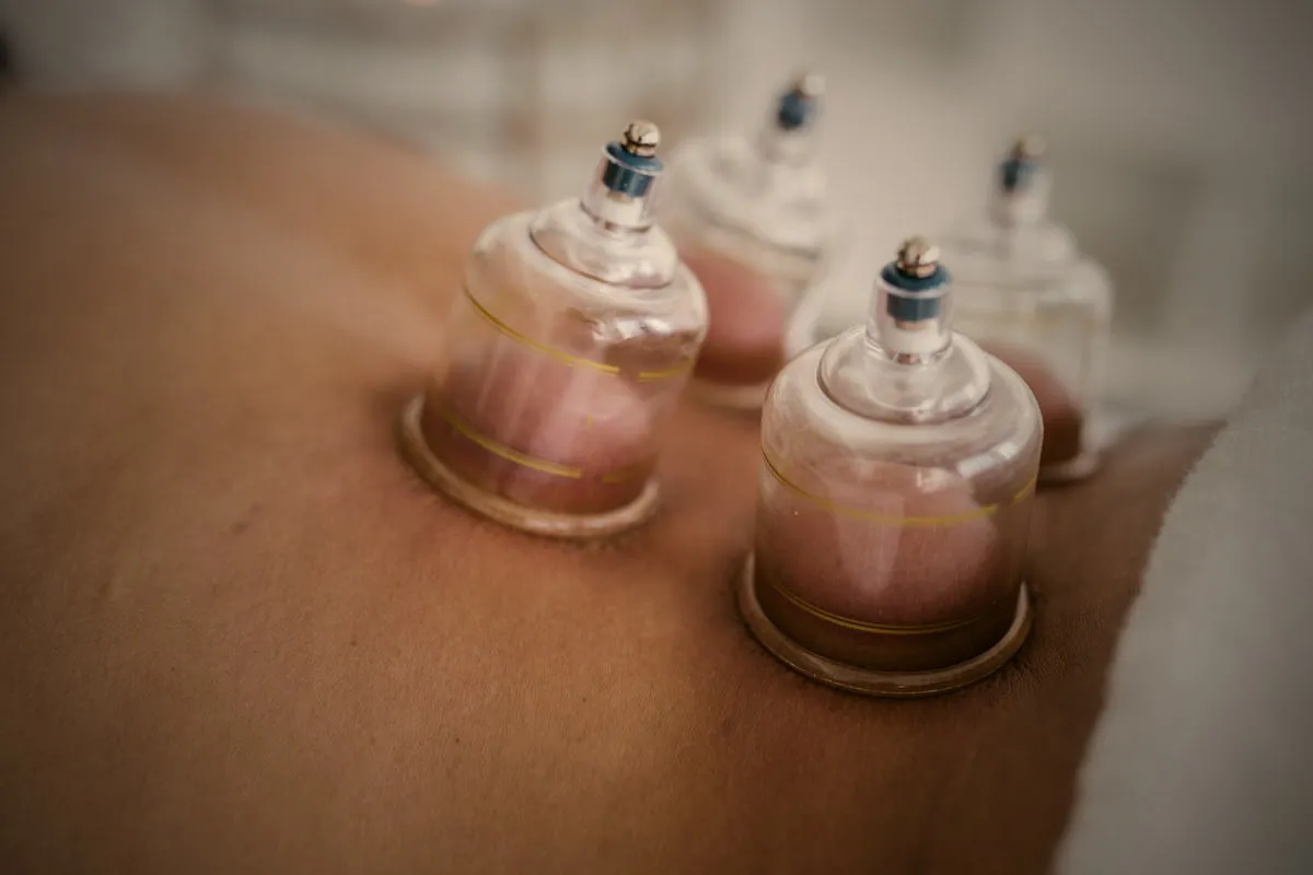 Formation Hijama à Genève · pose de ventouses lors d’une séance de cupping
